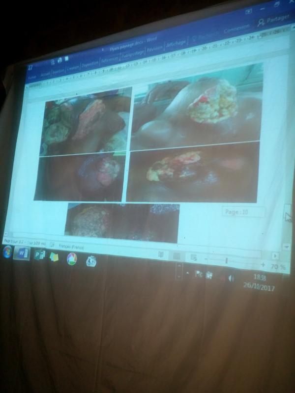 OCTOBRE ROSE_ Projection débat