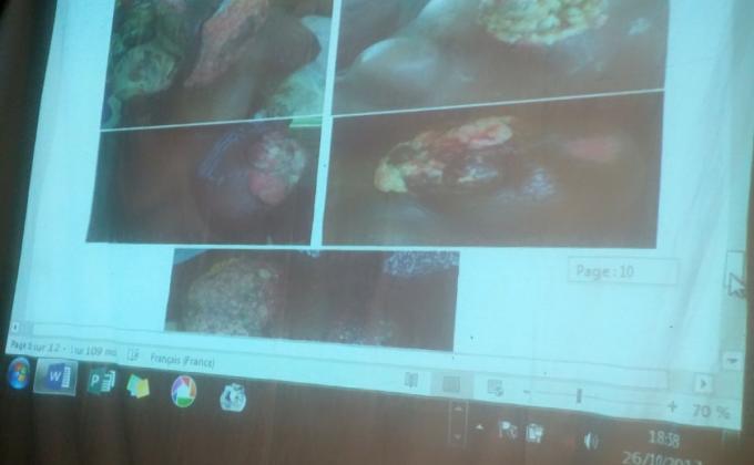 OCTOBRE ROSE_ Projection débat