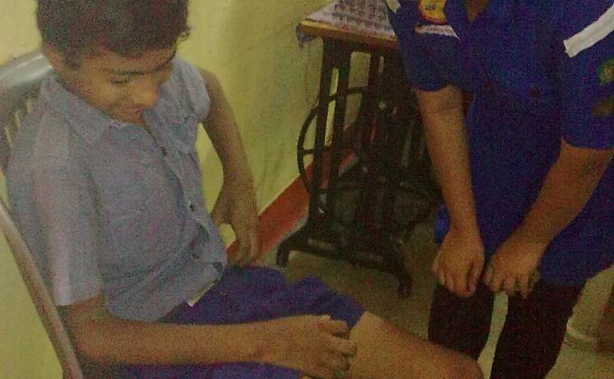 Help to Mentally Challenged people