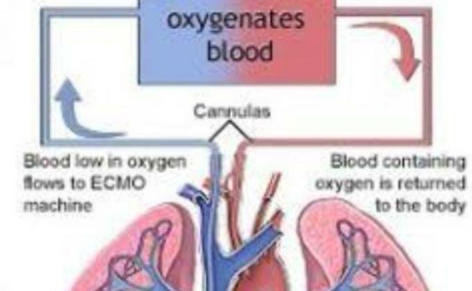 CRITICALCARE MEDICINE